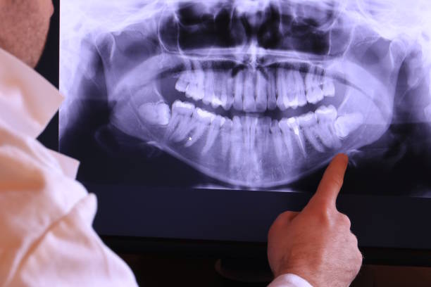 Best Emergency Treatment for Oral Infections in Columbus Junction, IA