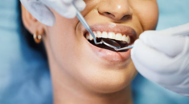 Professional Emergency Dental Service in IA